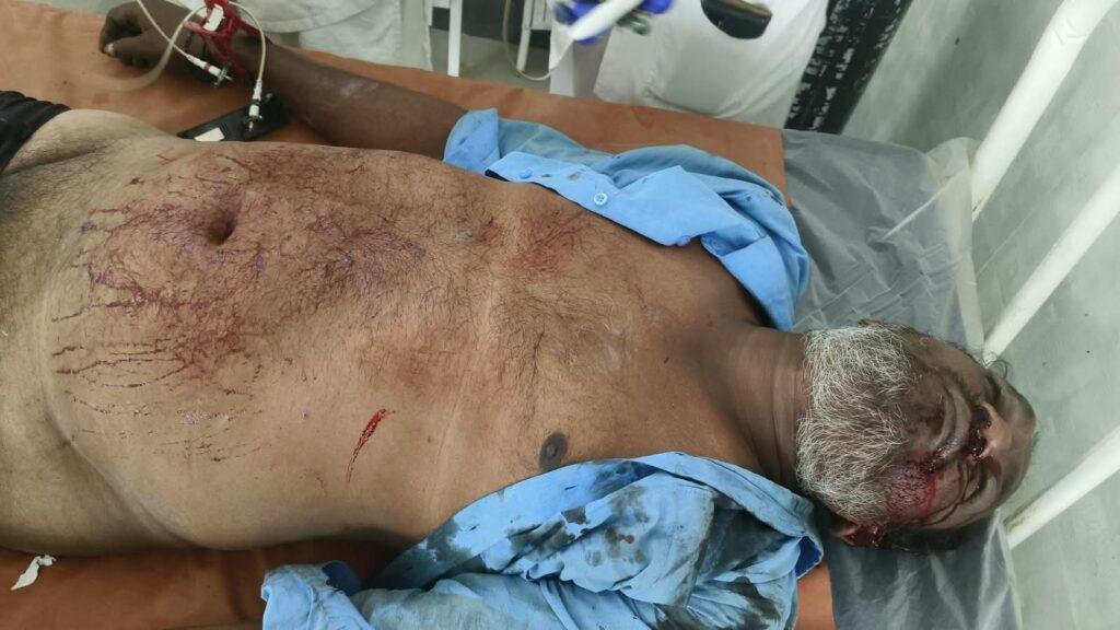 ఆర్టీసీ బస్సు ఢీకొని గుర్తుతెలియని వ్యక్తి మృతి